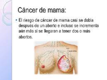 Cáncer de mama, consecuencia del aborto